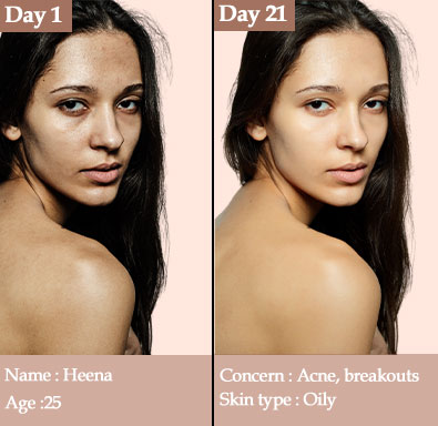Before And After