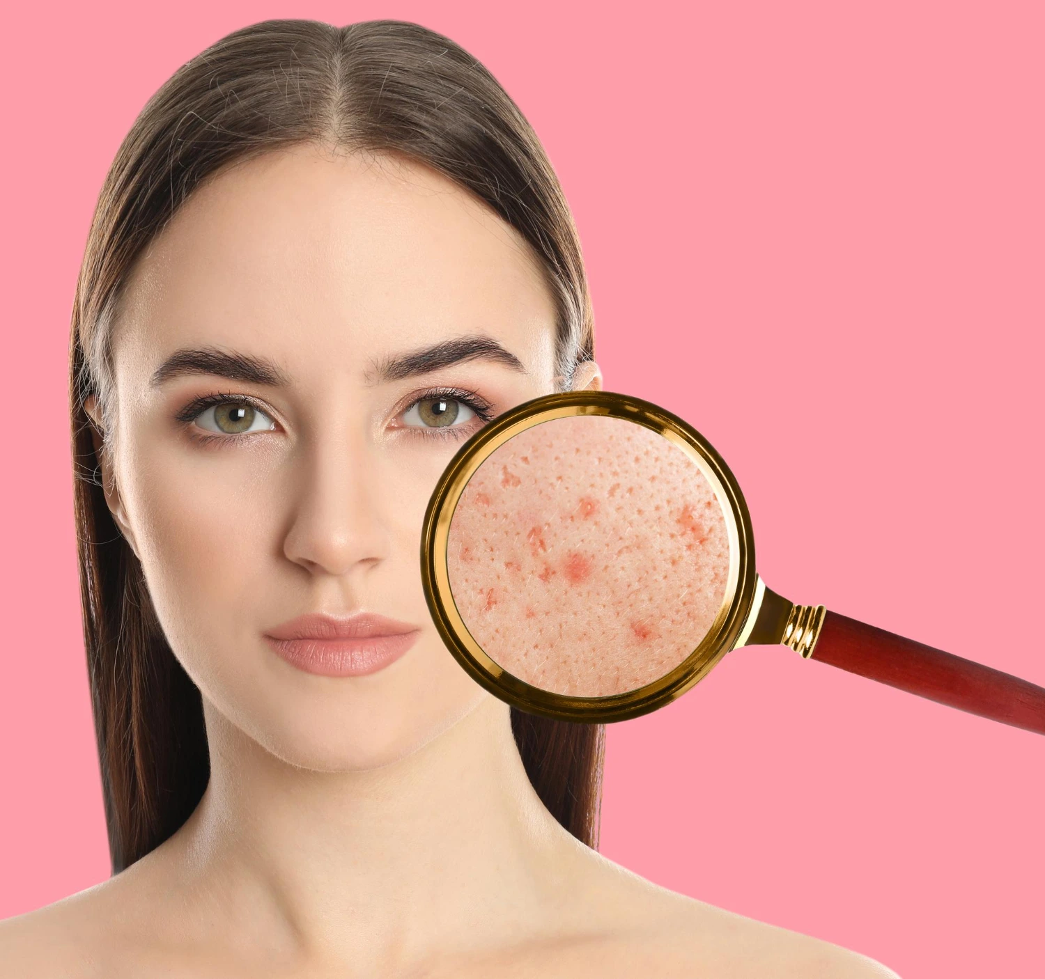 Reduces Acne and Blemishes