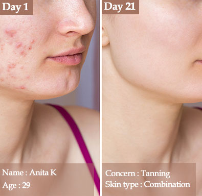 combination-skin